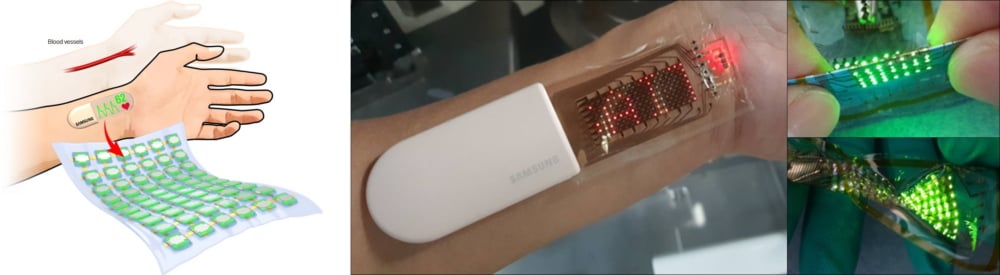 Samsung OLED skin patch